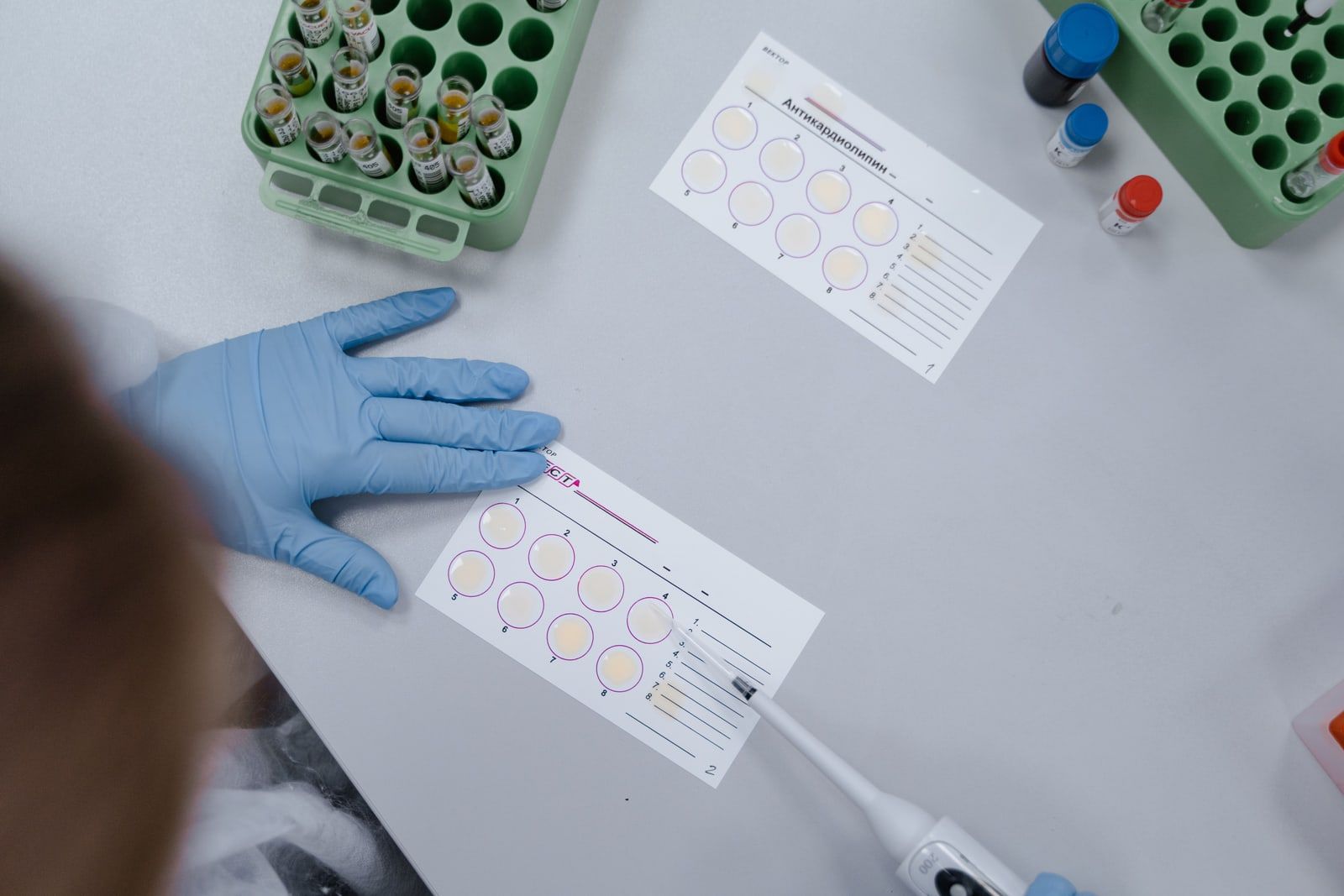 A laboratory bench with pipettes and sample tubes