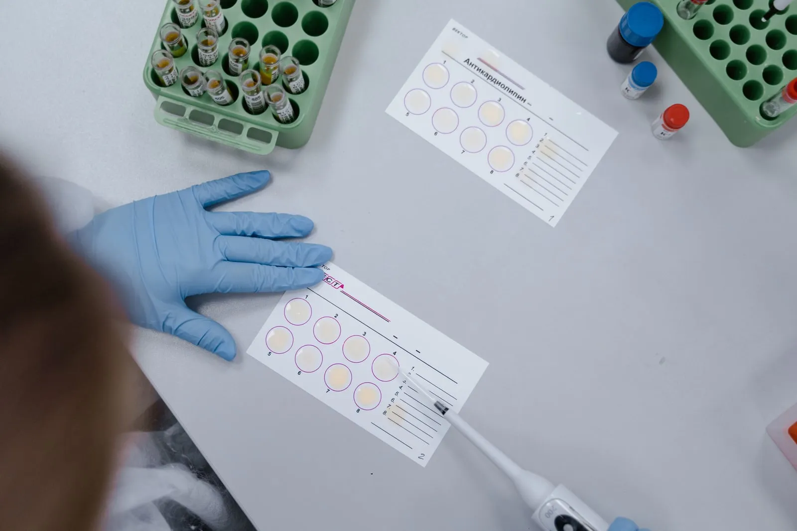 A scientist working at a laboratory bench with samples