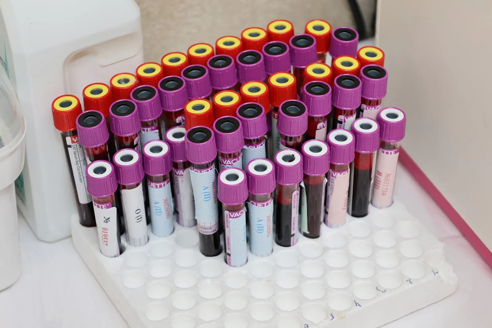 Rows of sample tubes in a laboratory rack